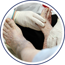 Management of Diabetic Foot Ulcers