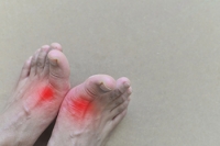 Painful Gout