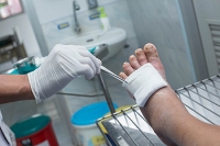 Dealing With Diabetic Foot Ulcers