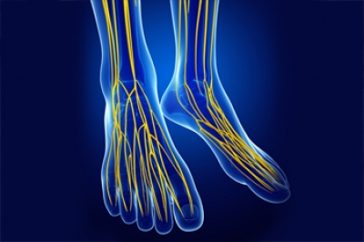 Damage to Nerves in the Foot