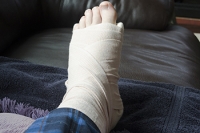 Diagnosis and Treatment of a Broken Foot